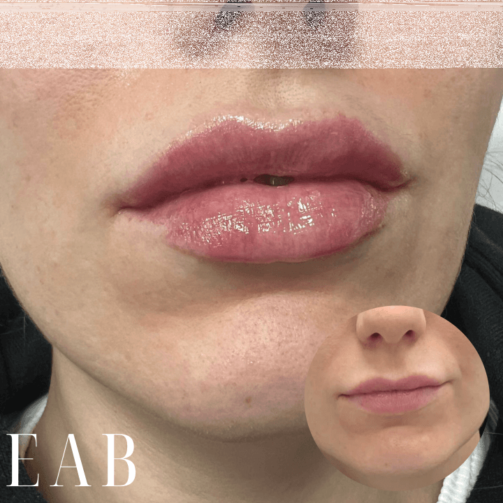 EAB Nurse Aesthetics image 2