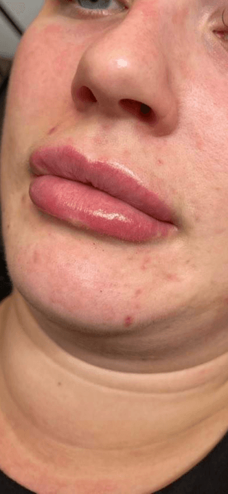 Libby shaw aesthetics image 1