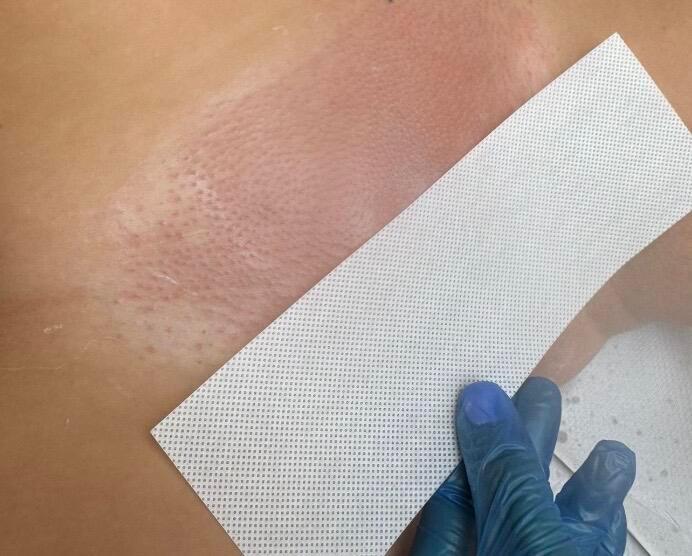 Eliminate waxingandlaser image 3