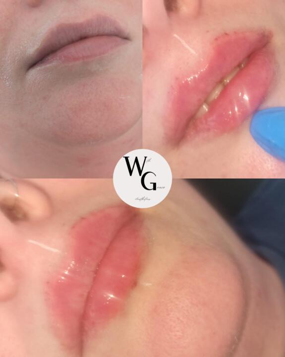 With Grace Aesthetics image 2