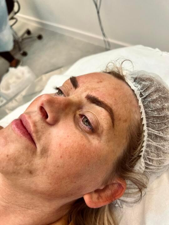 Perfect Arch Microblading image 3