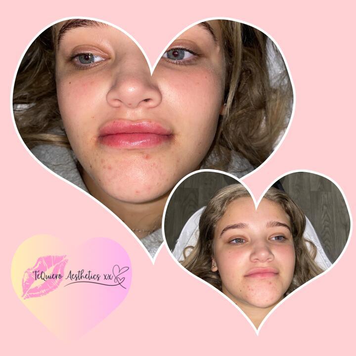 TeQuiero Aesthetics xx image 3