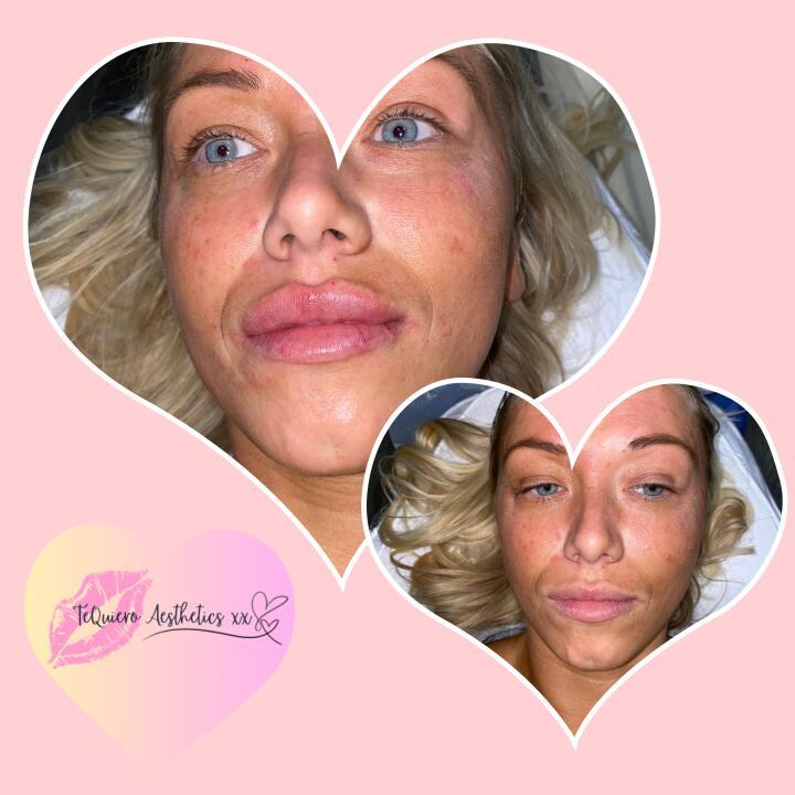 TeQuiero Aesthetics xx image 2