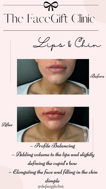The FaceGift Clinic image 2