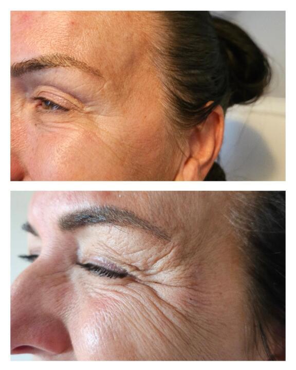 Lumiti Skin and Aesthetics image 2