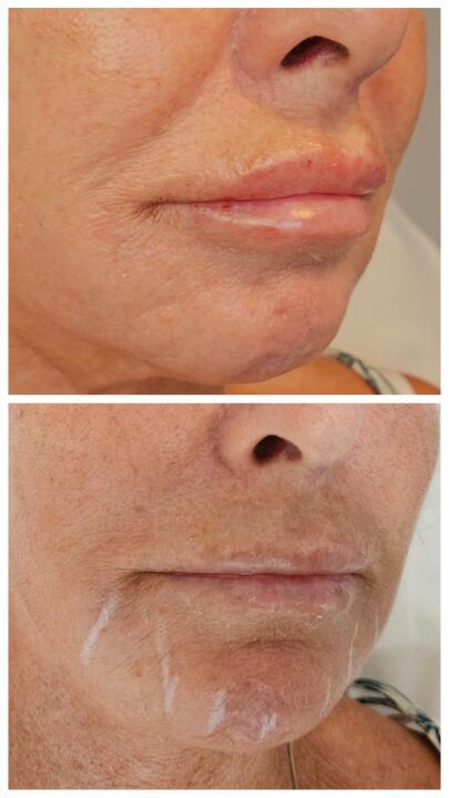 Lumiti Skin and Aesthetics image 3