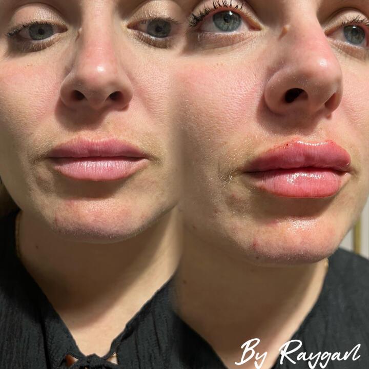 Raygan aesthetics image 1