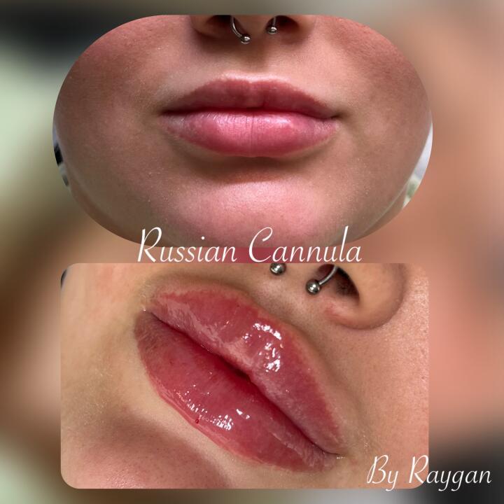 Raygan aesthetics image 3
