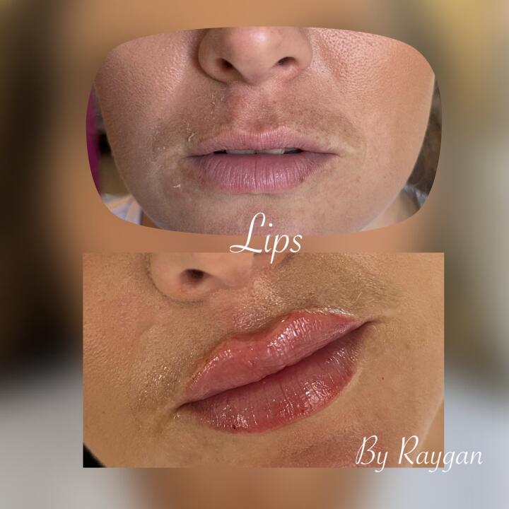Raygan aesthetics image 2