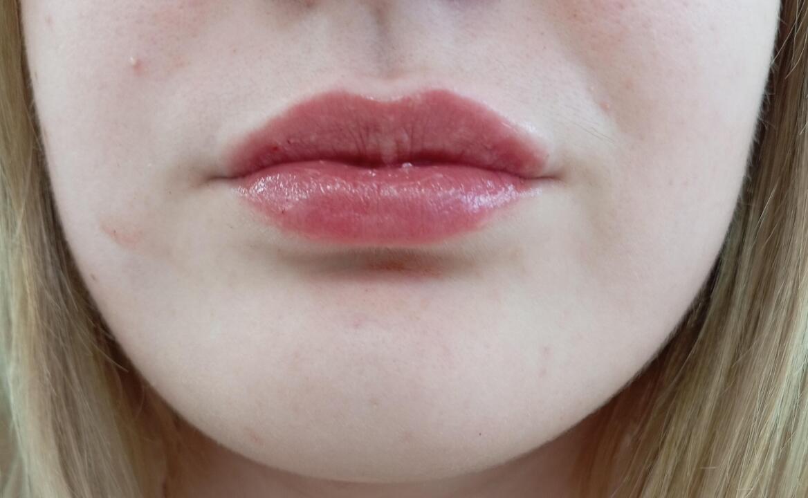 Emma Jane aesthetics image 3