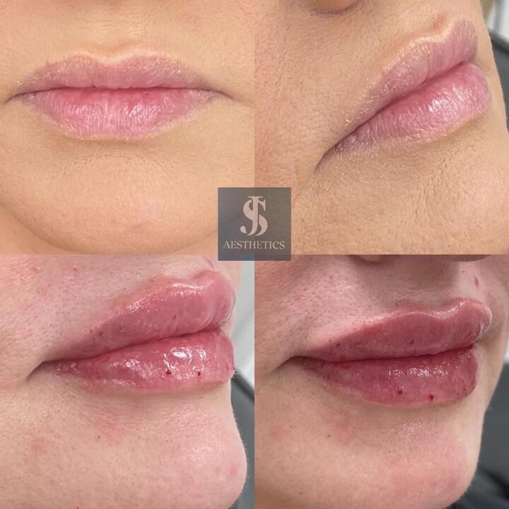 6th Avenue hair salon -  JS Aesthetics clinic image 1