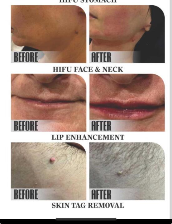 Dk Asethetics skin and body clinic LTD Draycott image 3