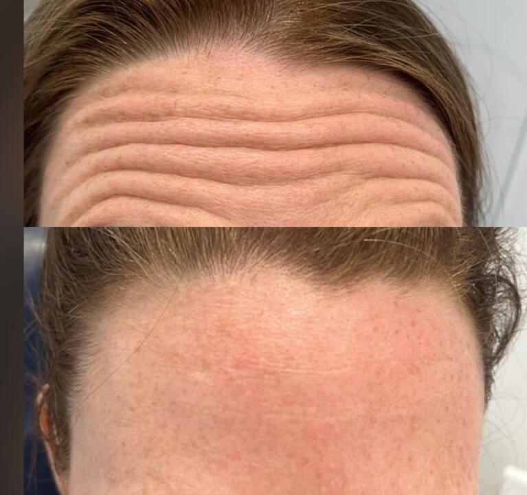 Dk Asethetics skin and body clinic LTD Draycott image 2