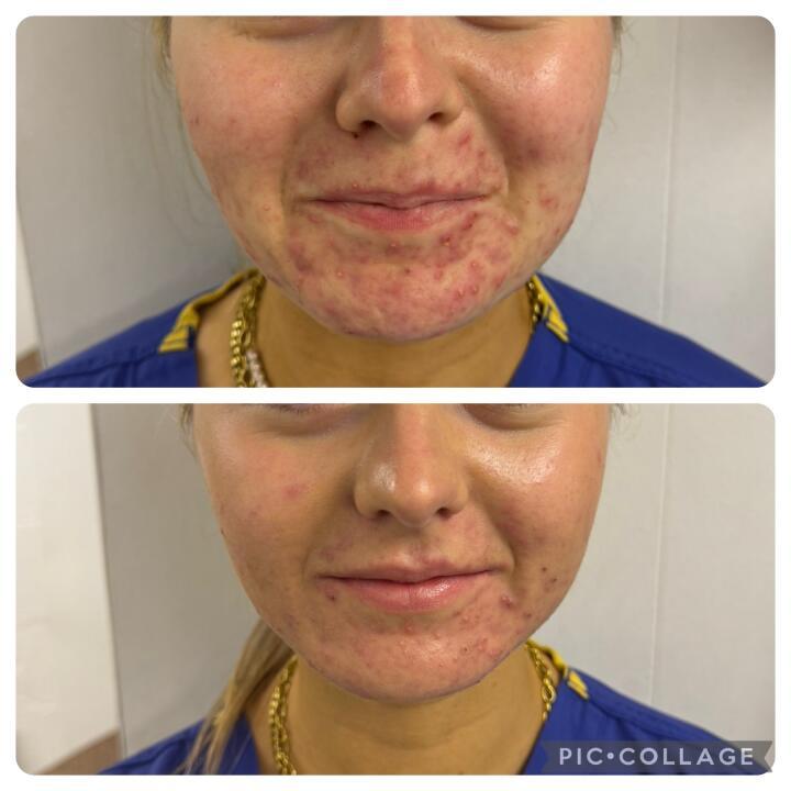 Your Hair and Beauty Skin clinic Bourne End image 1