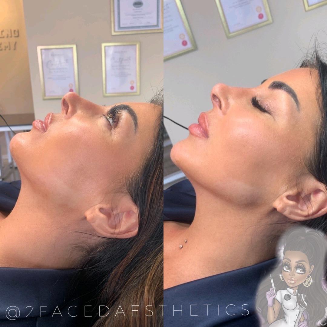 Two Faced Aesthetics Academy image 3