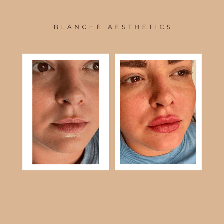 Skin aesthetics Birmingham image 2
