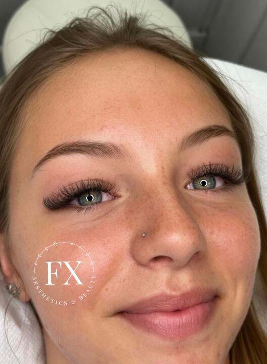 FX Aesthetics and Beauty image 3