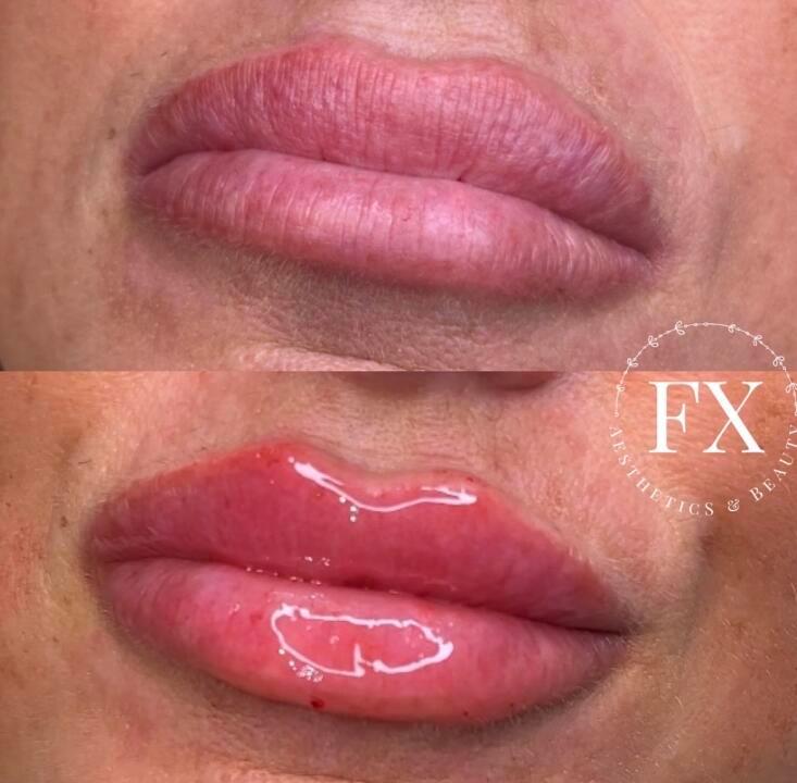 FX Aesthetics and Beauty image 2