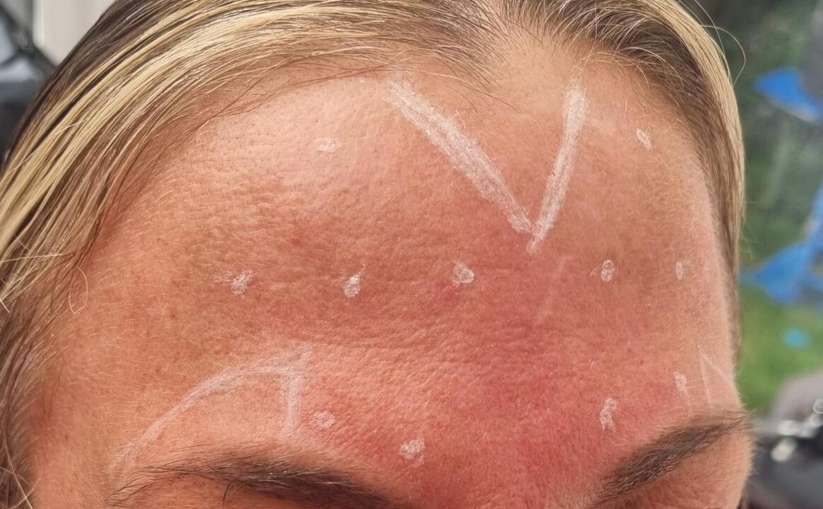 Anti ageing image 2