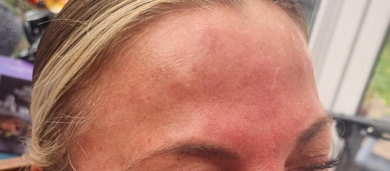 Anti ageing image 3