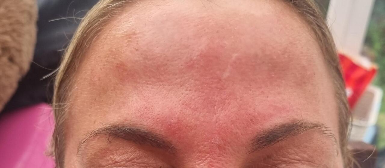 Anti ageing image 1