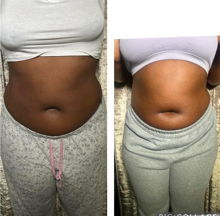 BsculptClinique image 3