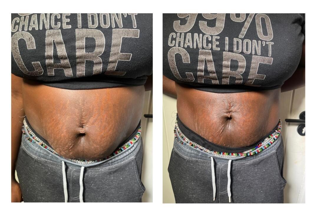 BsculptClinique image 1