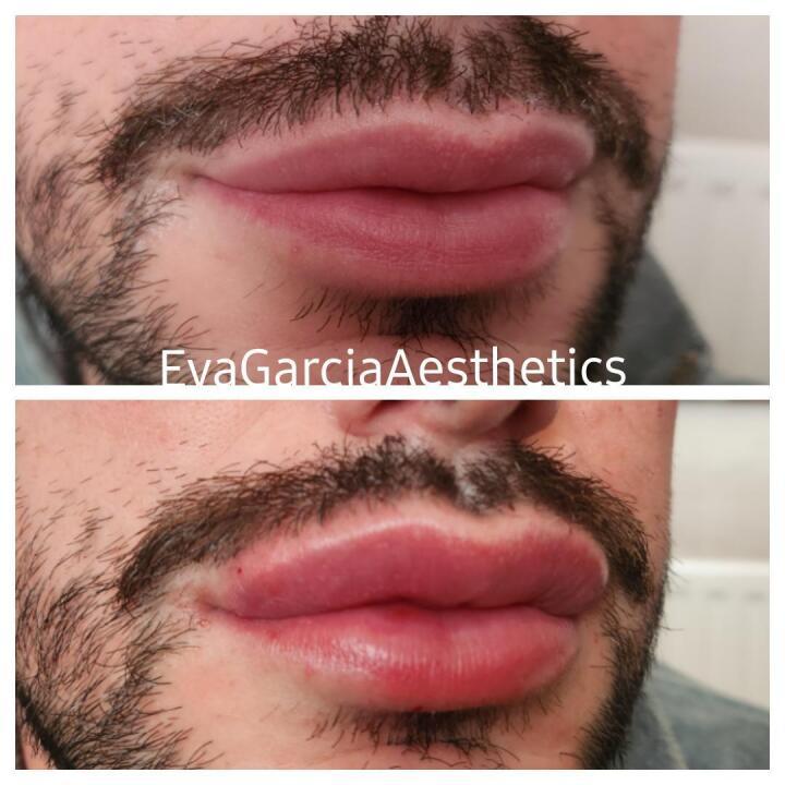 EvaGarciaAesthetics image 3