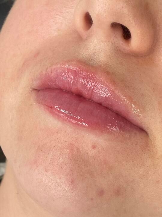 Shanellesnaturalaesthetics image 3