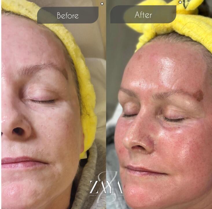 ZAYA luxury aesthetics and wellness clinic image 1