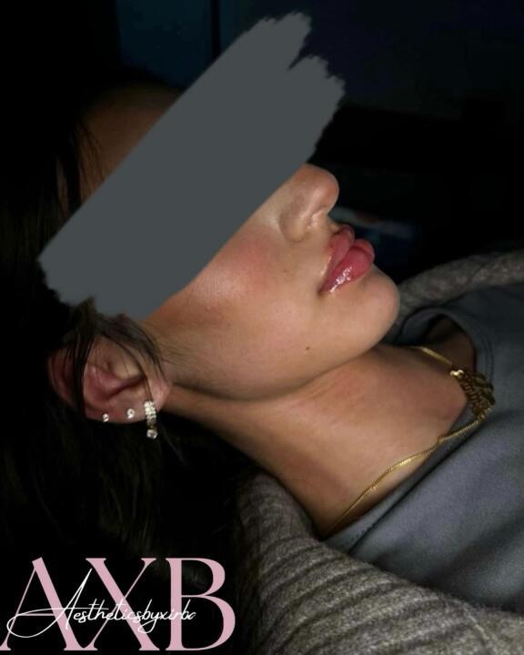 Aestheticsbyxirba image 3