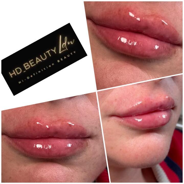 HD BeautyLdn image 2