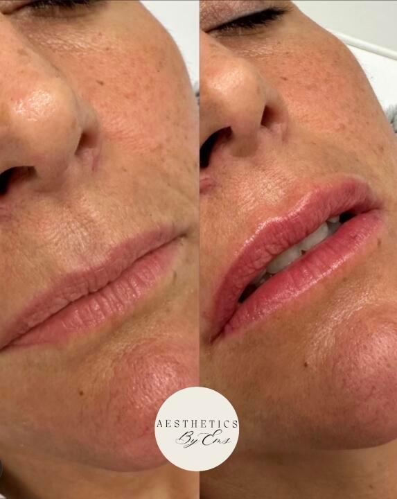 Aesthetics By Ems, Ashford Kent image 3