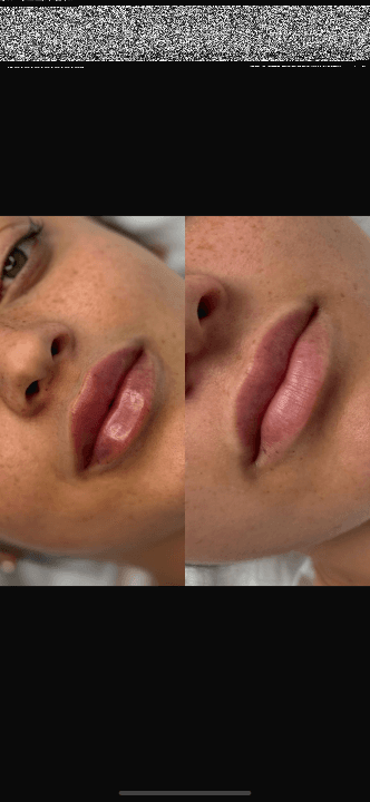 MedWave Aesthetics image 1