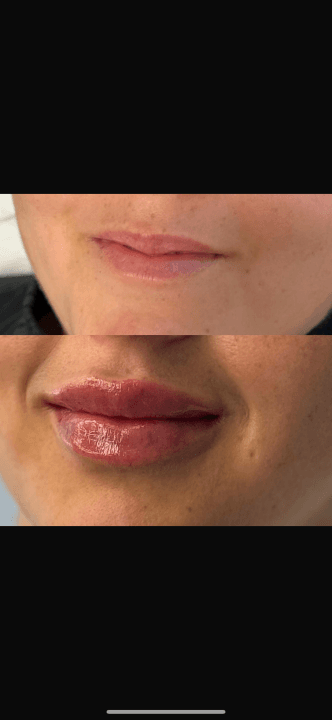 MedWave Aesthetics image 2