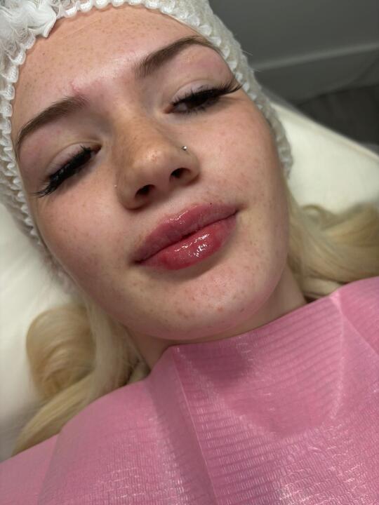 CP aesthetics image 3