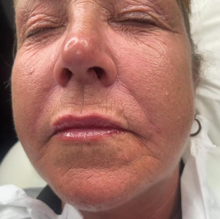 Simplicity skin clinic ltd image 1