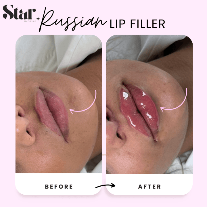 Star aesthetics image 2