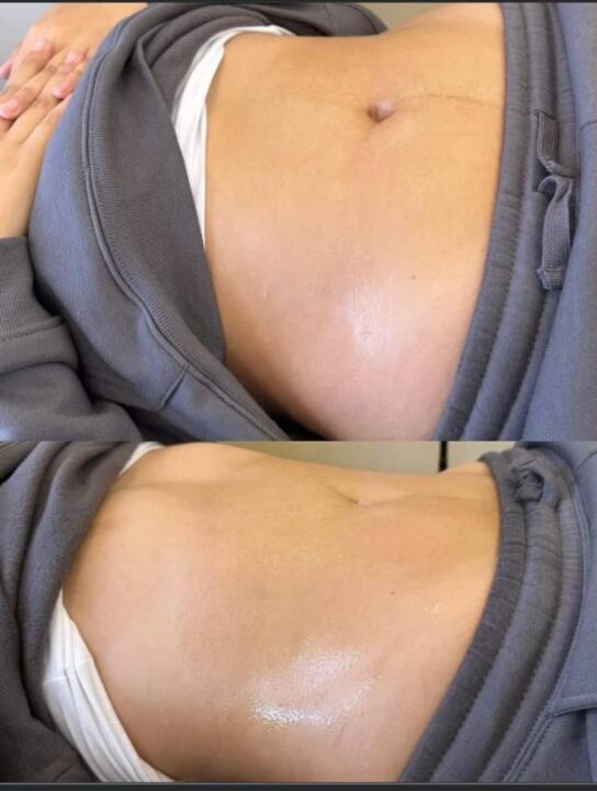Sleek Silhouettes body contouring image 1