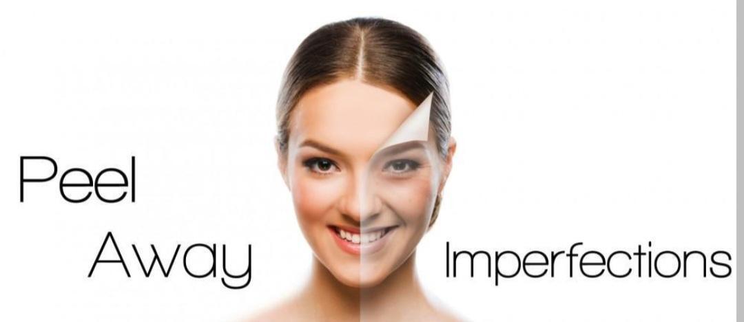 Aspley image 1