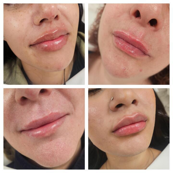 In Timeless skin clinic image 2