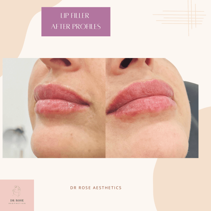 Dr Rose Aesthetics image 2