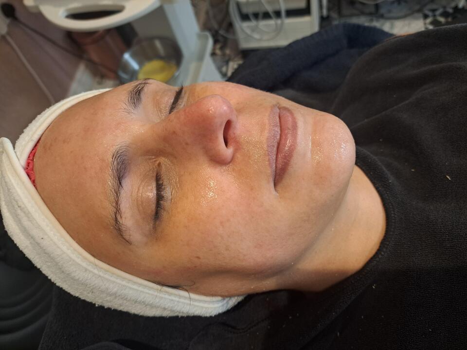 UrSkinClinic image 2