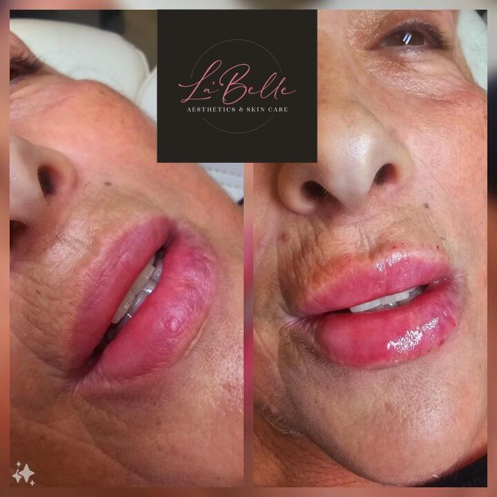 La'Belle Aesthetics image 2