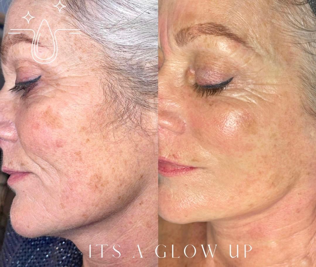 HIbrow Cosmetic Clinic image 3