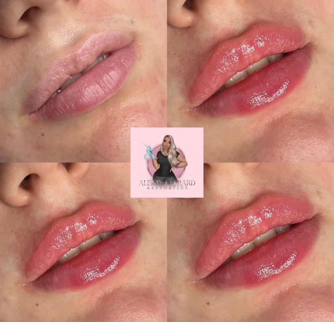 Alison Everard Aesthetics image 1
