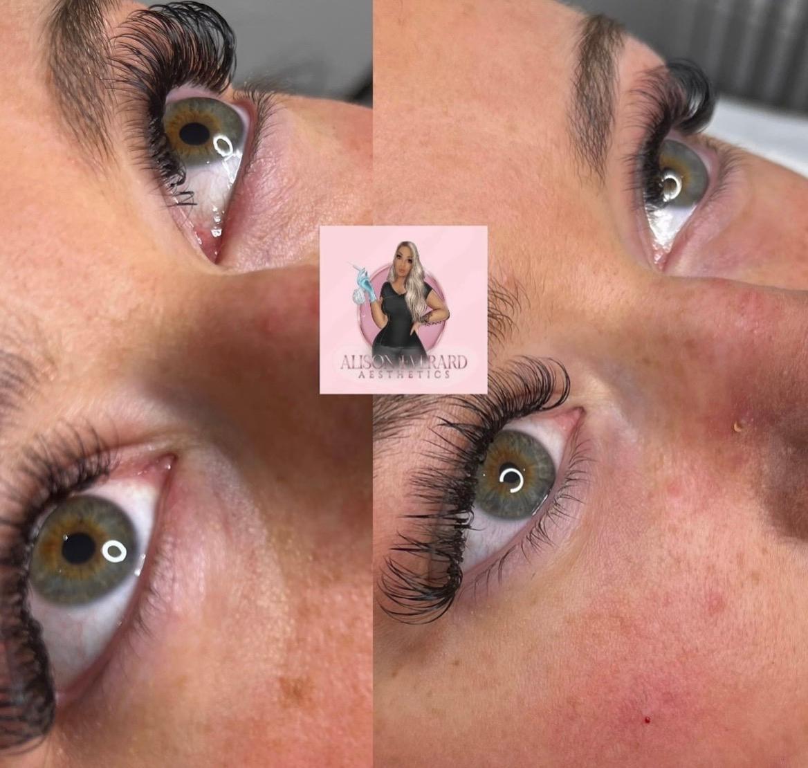 Alison Everard Aesthetics image 2