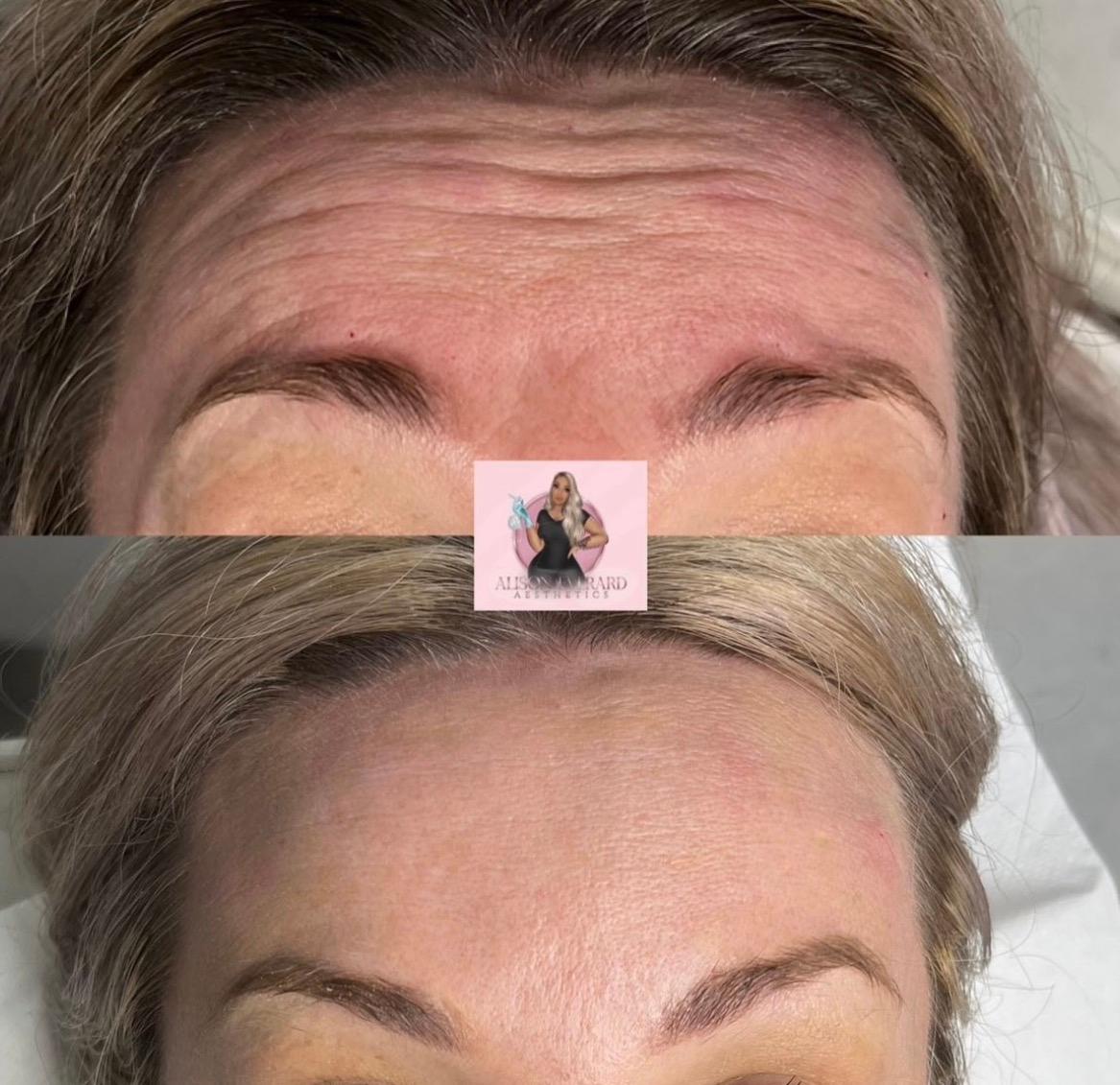 Alison Everard Aesthetics image 3