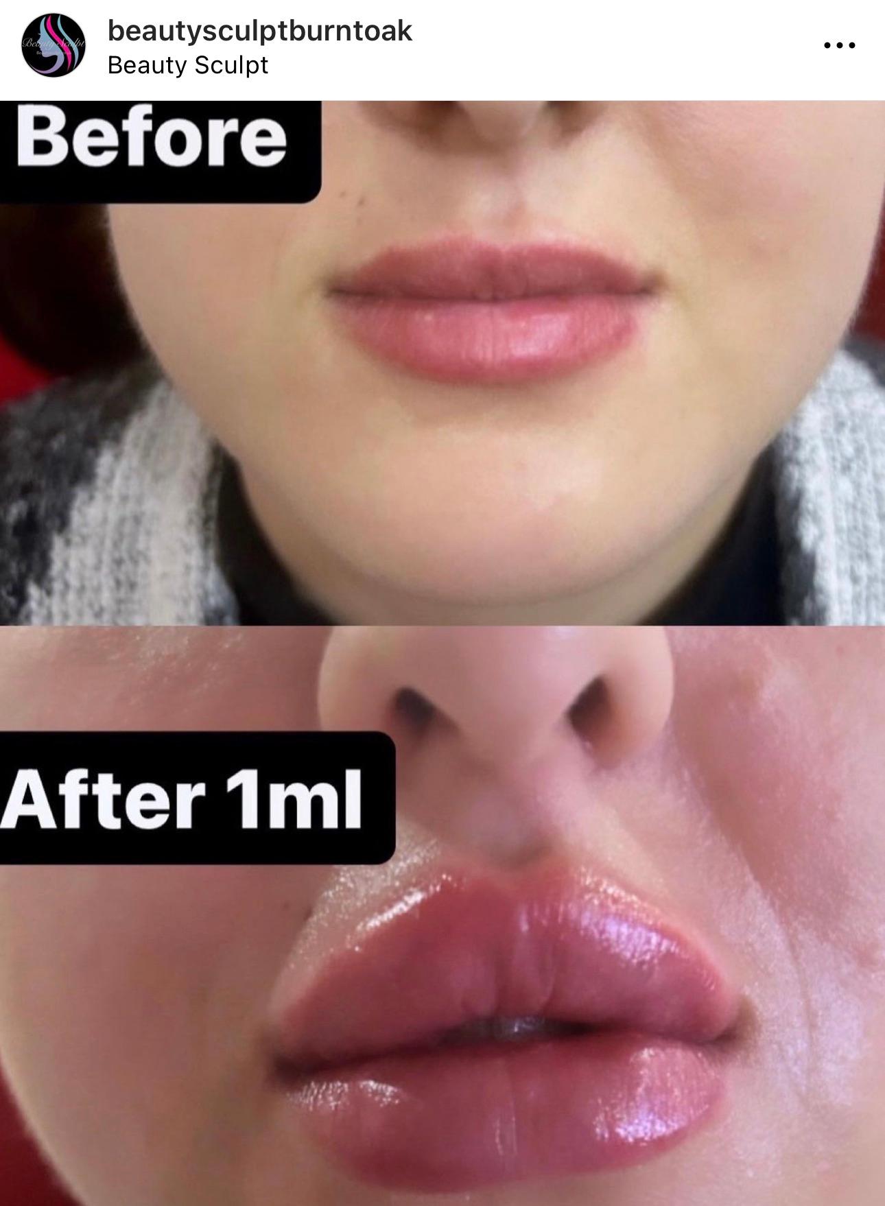 Beauty Sculpt image 2