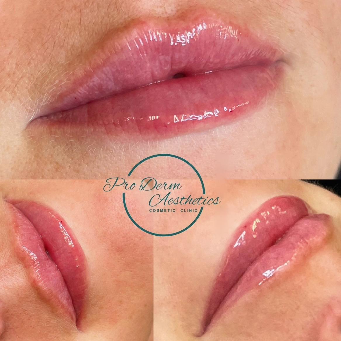 Pro Derm Aesthetics image 3